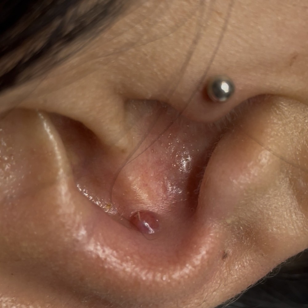 Revisión de piercing de otro estudio — Renzo Piercer